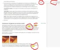 randen.webp randen.webp
