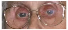 zonder-flits.webp